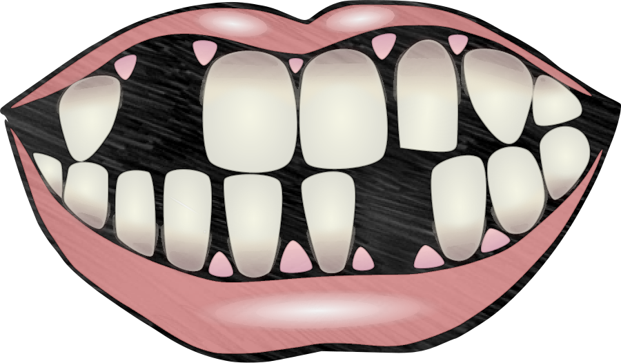 This visual is about mouth teeth lips funny freetoedit #mouth #teeth #lips ...
